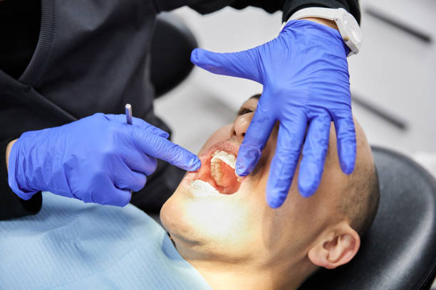 Best Urgent Dental Care for Toothaches in Manche North Shore, CA