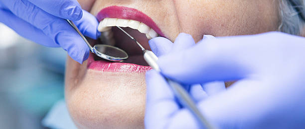 Best Dental Abscess Treatment in Manche North Shore, CA